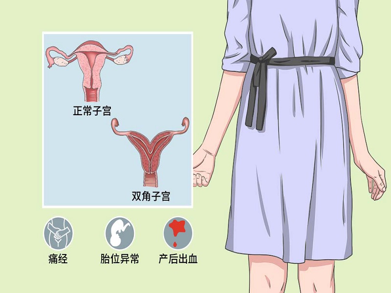 双角子宫